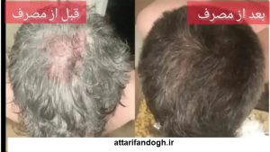 رفع سفیدی مو با هلیله سیاه