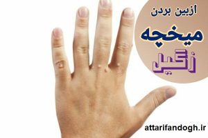از بین بردن میخچه و زگیل