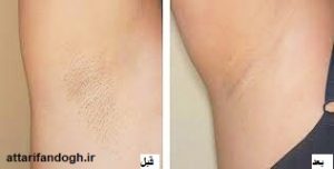 خاصیت روغن مورچه و طریقه مصرف